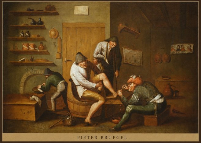 Pieter Bruegel The Foot Operation No5 - Affiche